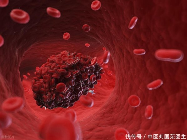 MOM操盘网 医生叮嘱：大蒜热油爆香产生反式脂肪酸，增加心血管疾病风险